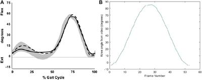 Bio-Inspired Knee Joint: Trends in the Hardware Systems Development